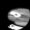 SPORK, NICO - 22.03.1976 - 02.08.2022 - CT obere Extremität - 17:51:17